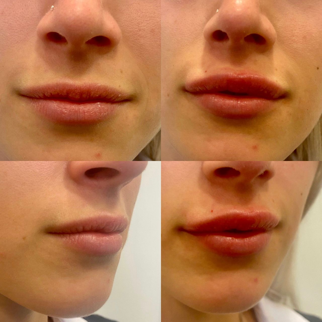 Pasquale Virciglio-35