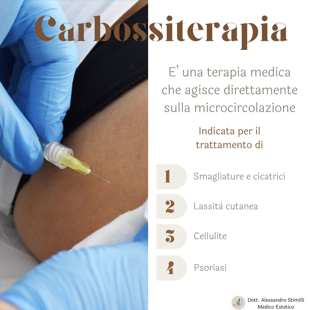 Alessandro Stimilli-4