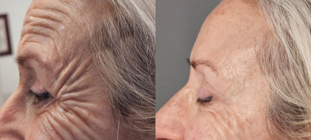 Rosalba Herrero Zerpa-19