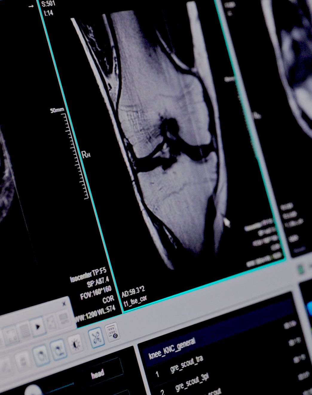 Pracownia Rezonansu Magnetycznego Rehasport-0