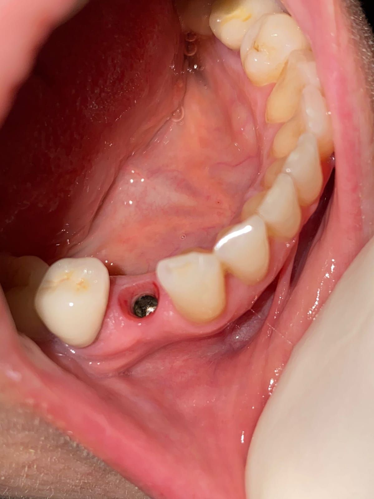 Gustavo Nefa Gaillez-4