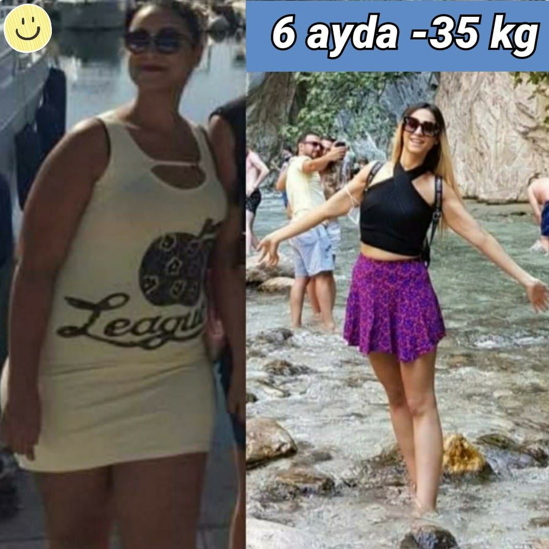 Tuğçe Özge Özyön-79