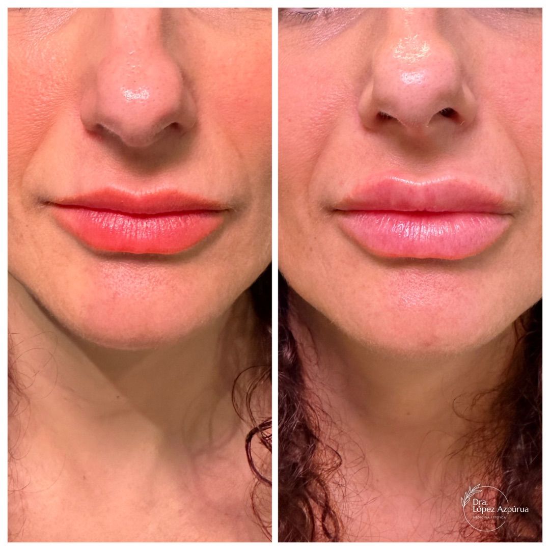 Alexandra López Azpúrua-8