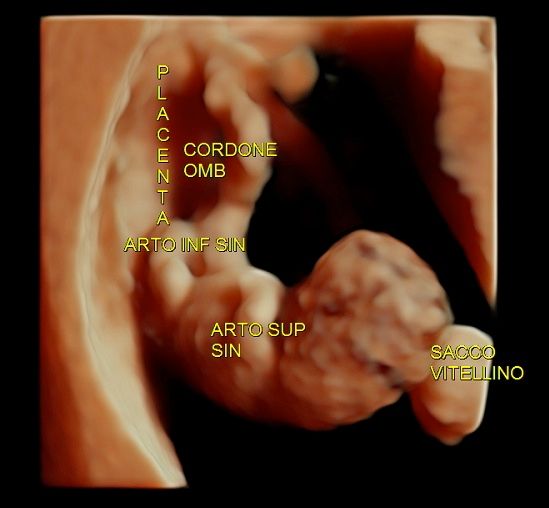 Tommaso Incandela-71