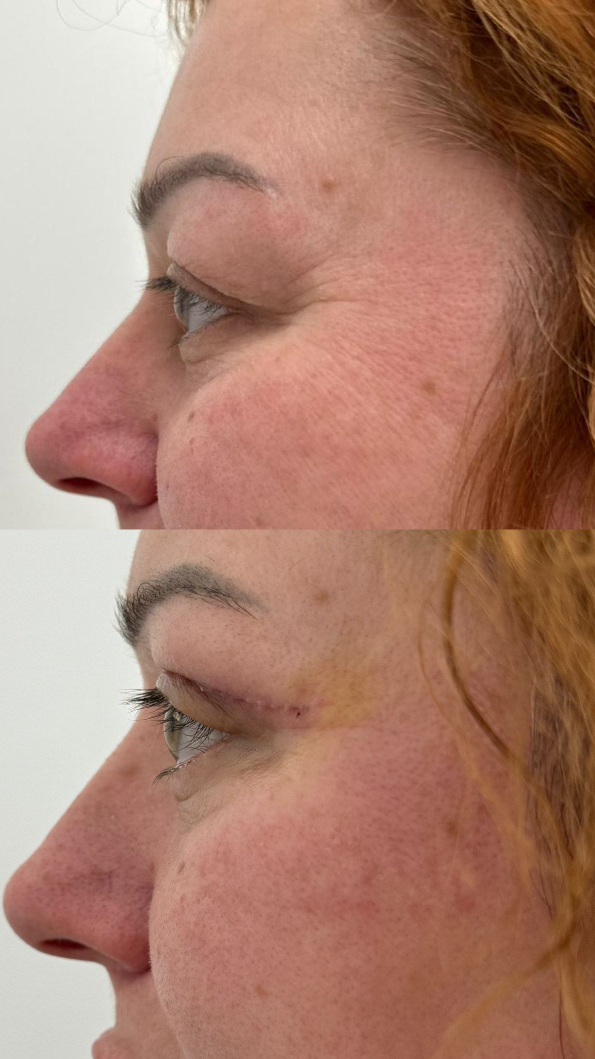 Katarzyna Kowalczyk-1