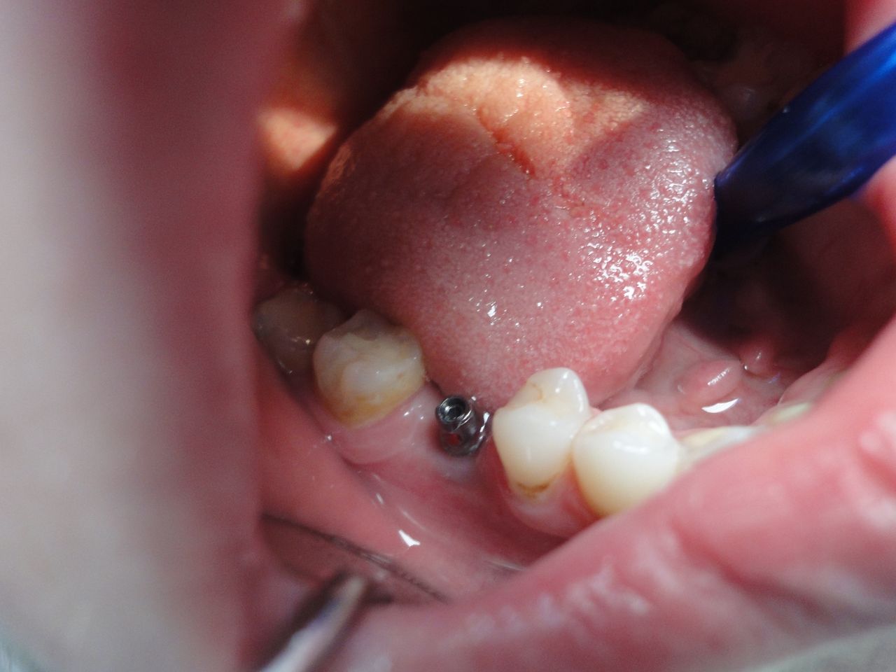 Krzysztof Zieliński-18