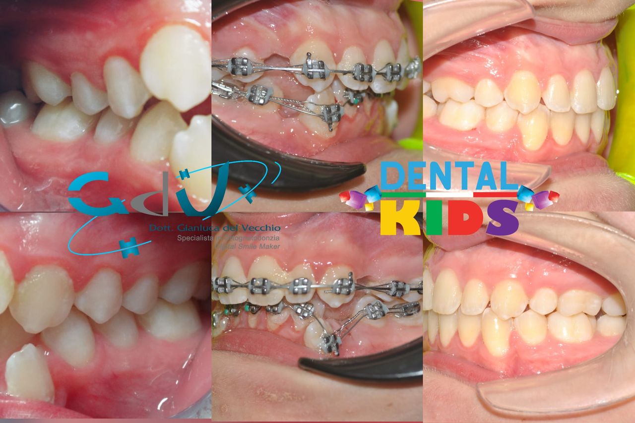 Gianluca Del Vecchio-170