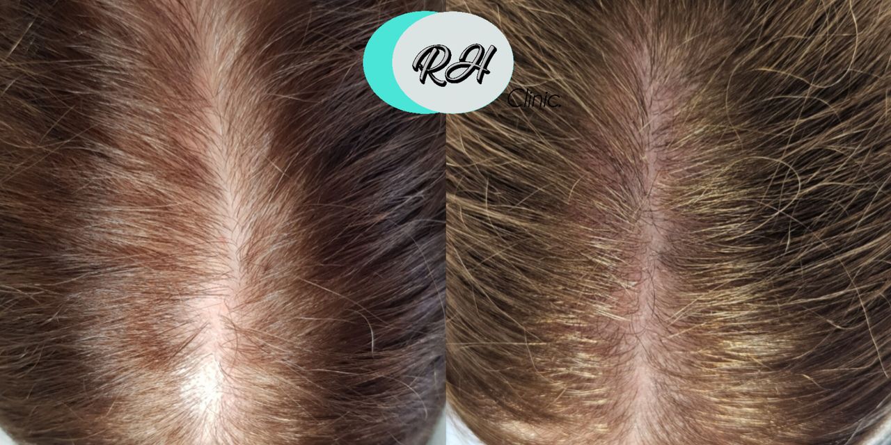 Rosalba Herrero Zerpa-592