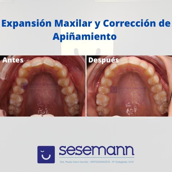 Paula Cano Carrillo-23