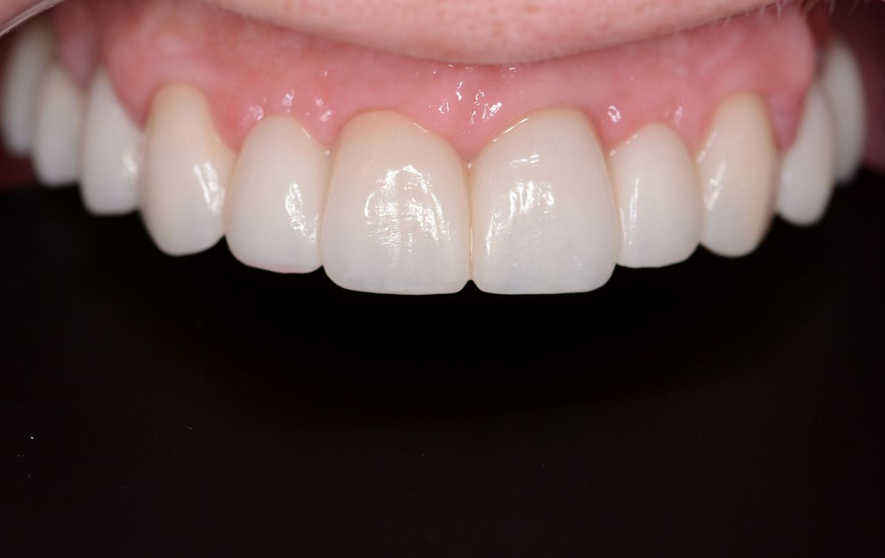 Magdalena Bińkowska-25