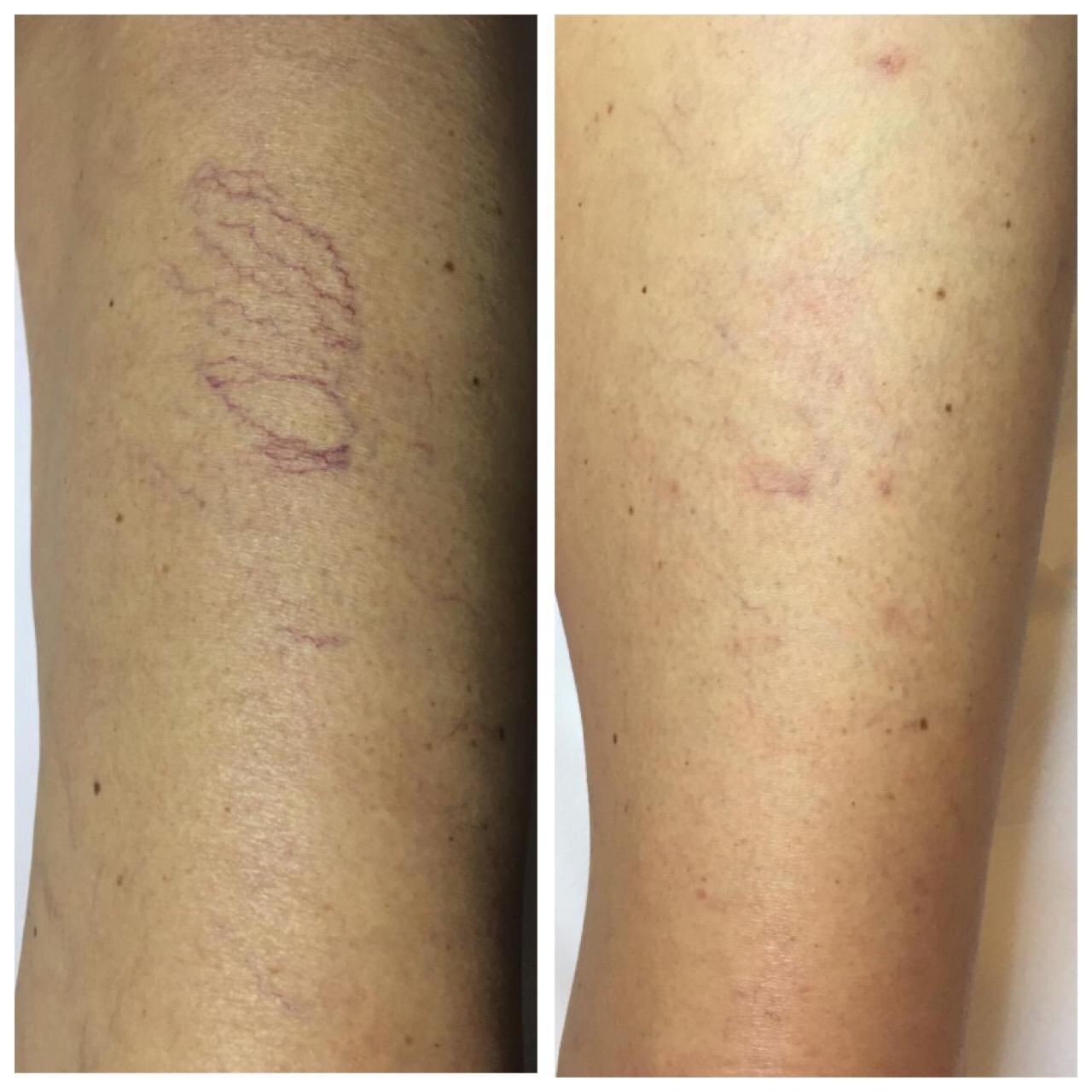 Bernardo Bottalico-5