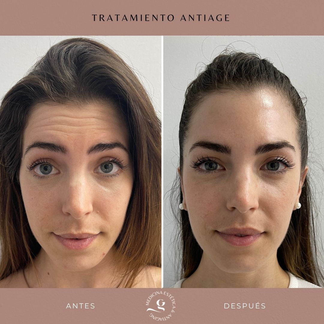 ​Giovanni Giorgianni-28