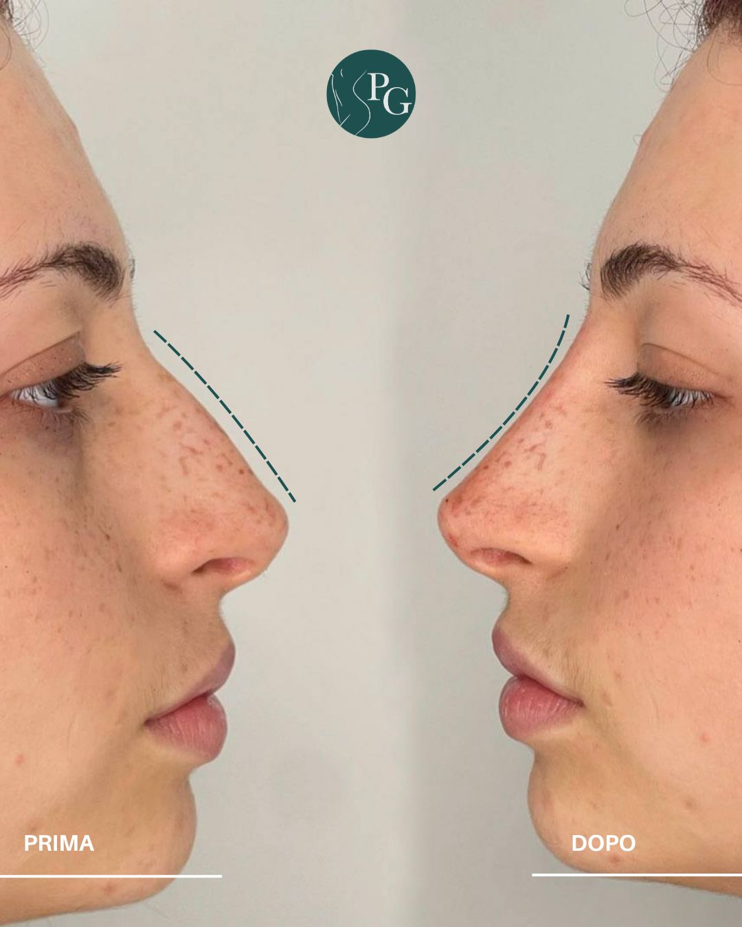 Pasquale Graziano-27