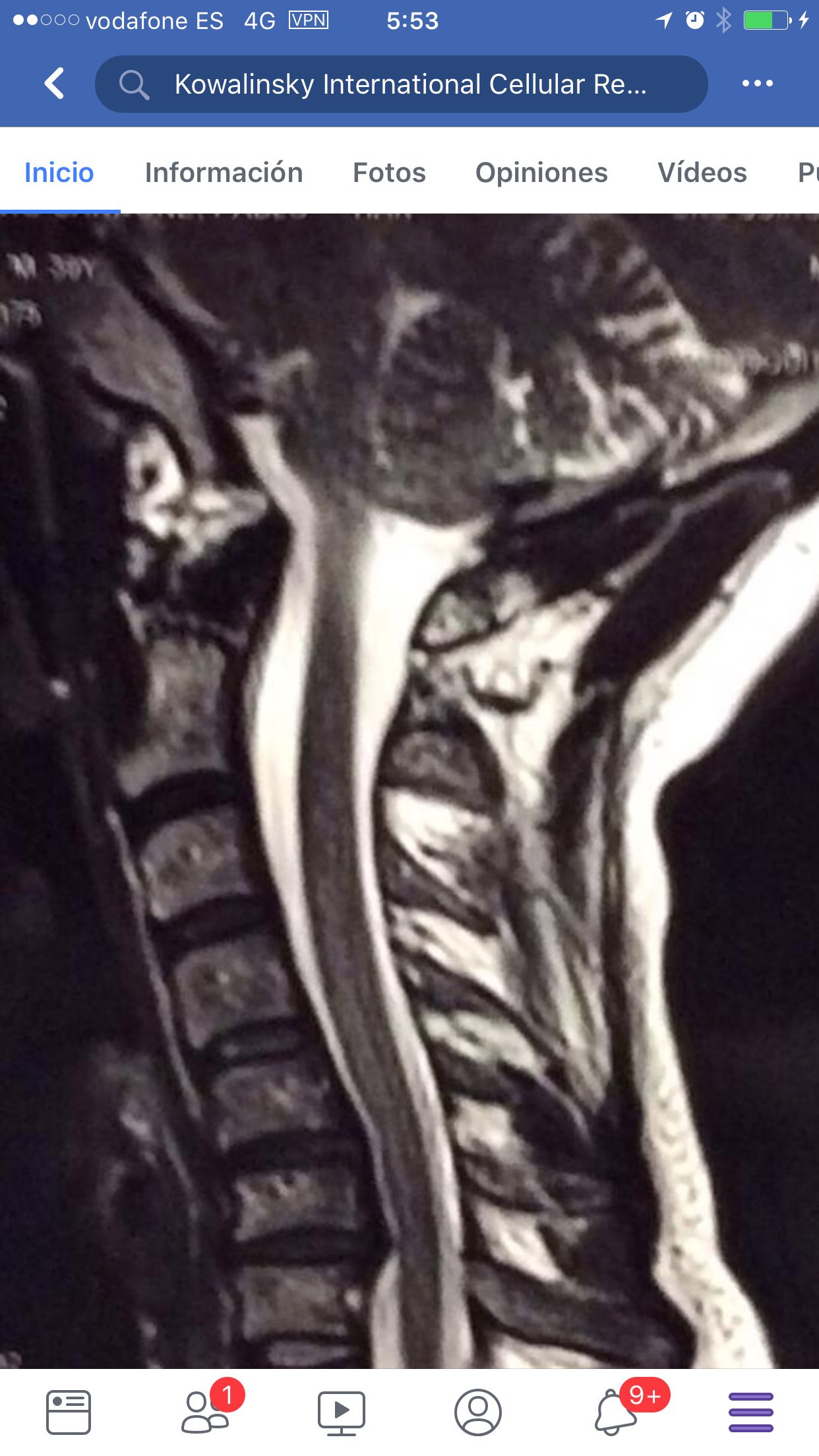 Juan Manuel Cowalinsky Millan-5