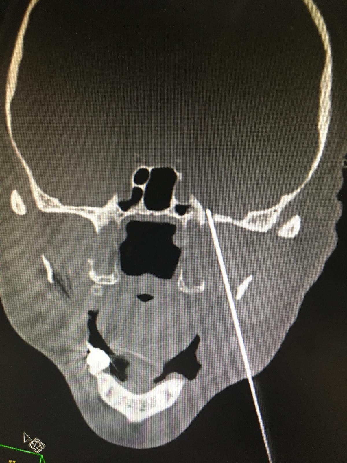 Carlos Morales Portillo-4