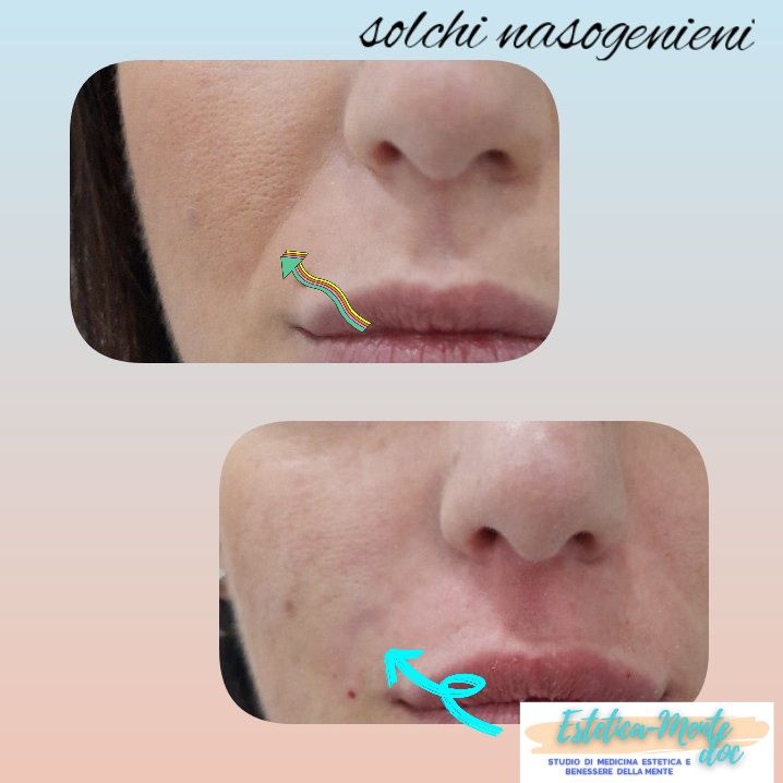 Paola Della Rocca-54