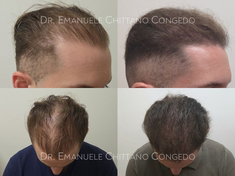 Emanuele Chittano Congedo-1