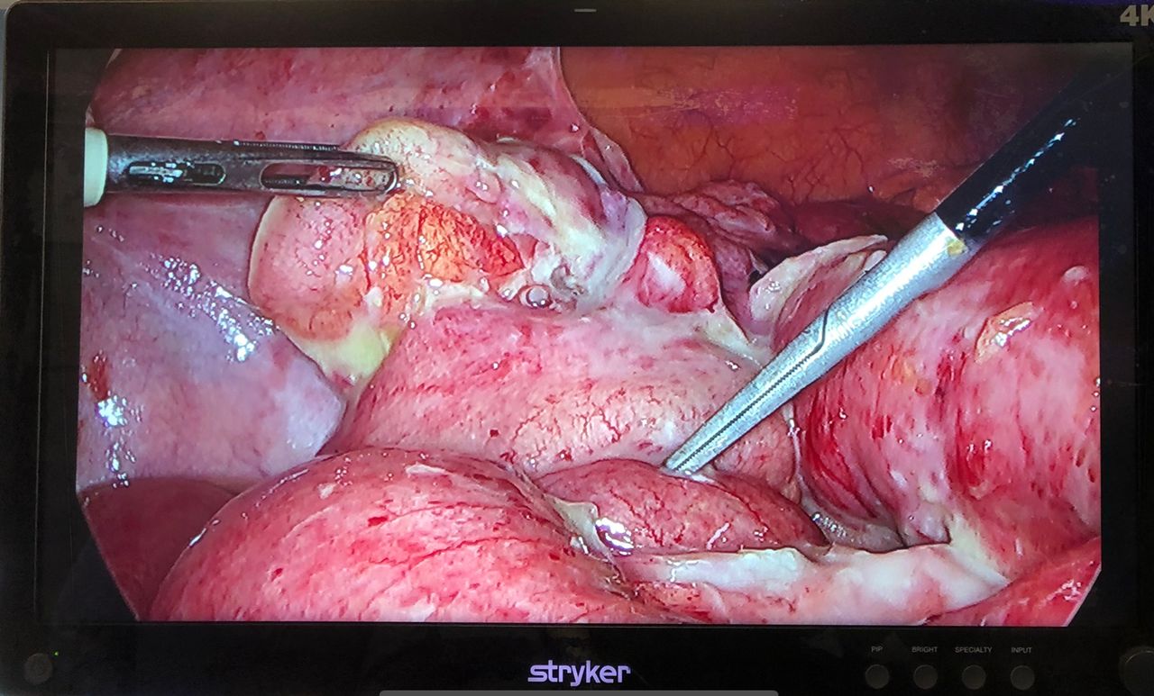 Antonio Ferronetti-4