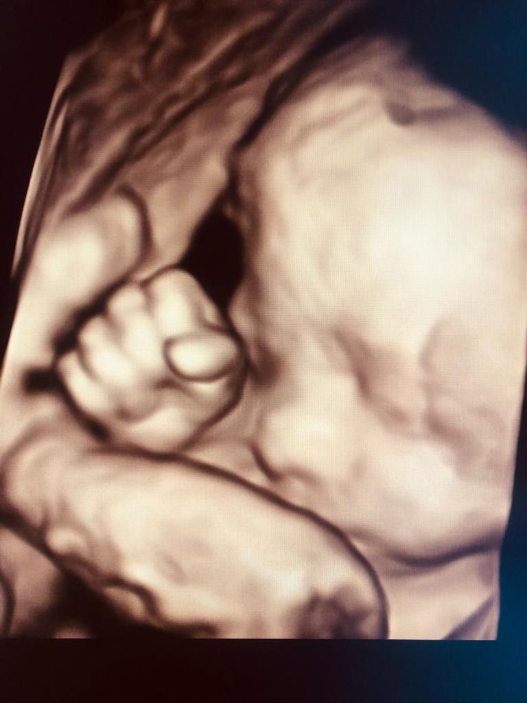 Dilek Turğut Kestane-10