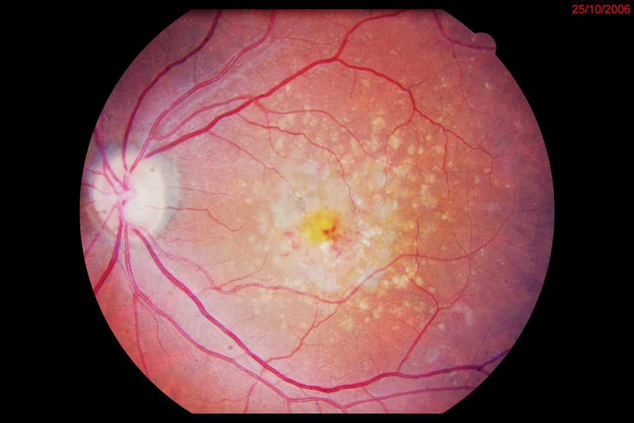 Paolo Andrea Marangoni-3