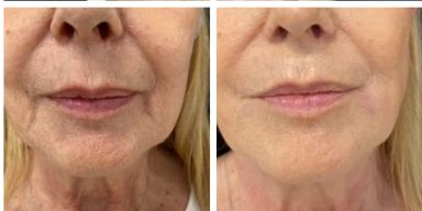 Silvia Melania Baio-25