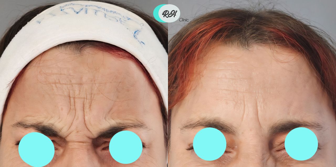 Rosalba Herrero Zerpa-594