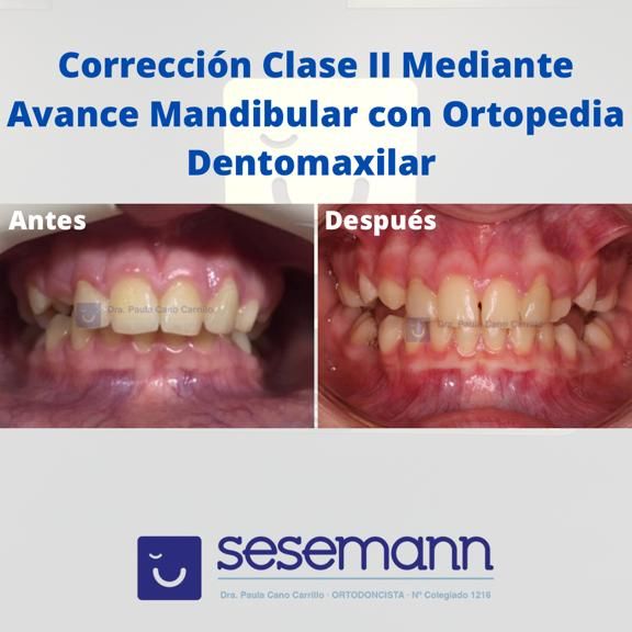 Paula Cano Carrillo-45