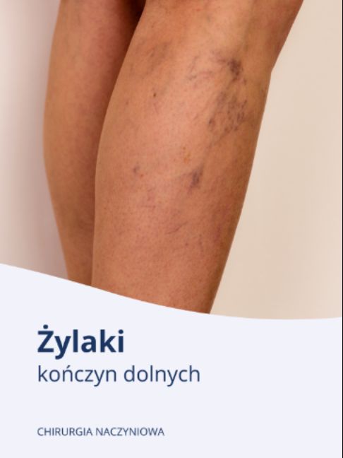 Krzysztof Jacyna-26