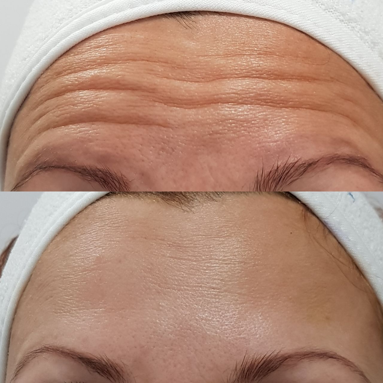 Rosalba Herrero Zerpa-352