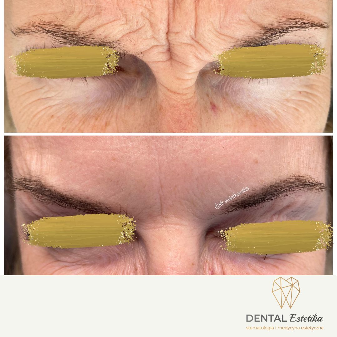 Angelika Świątkowska-29