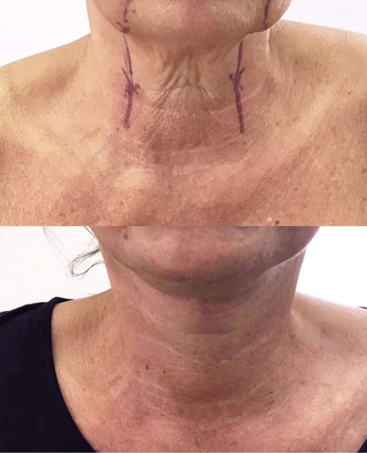 Angelo De Cataldis-2