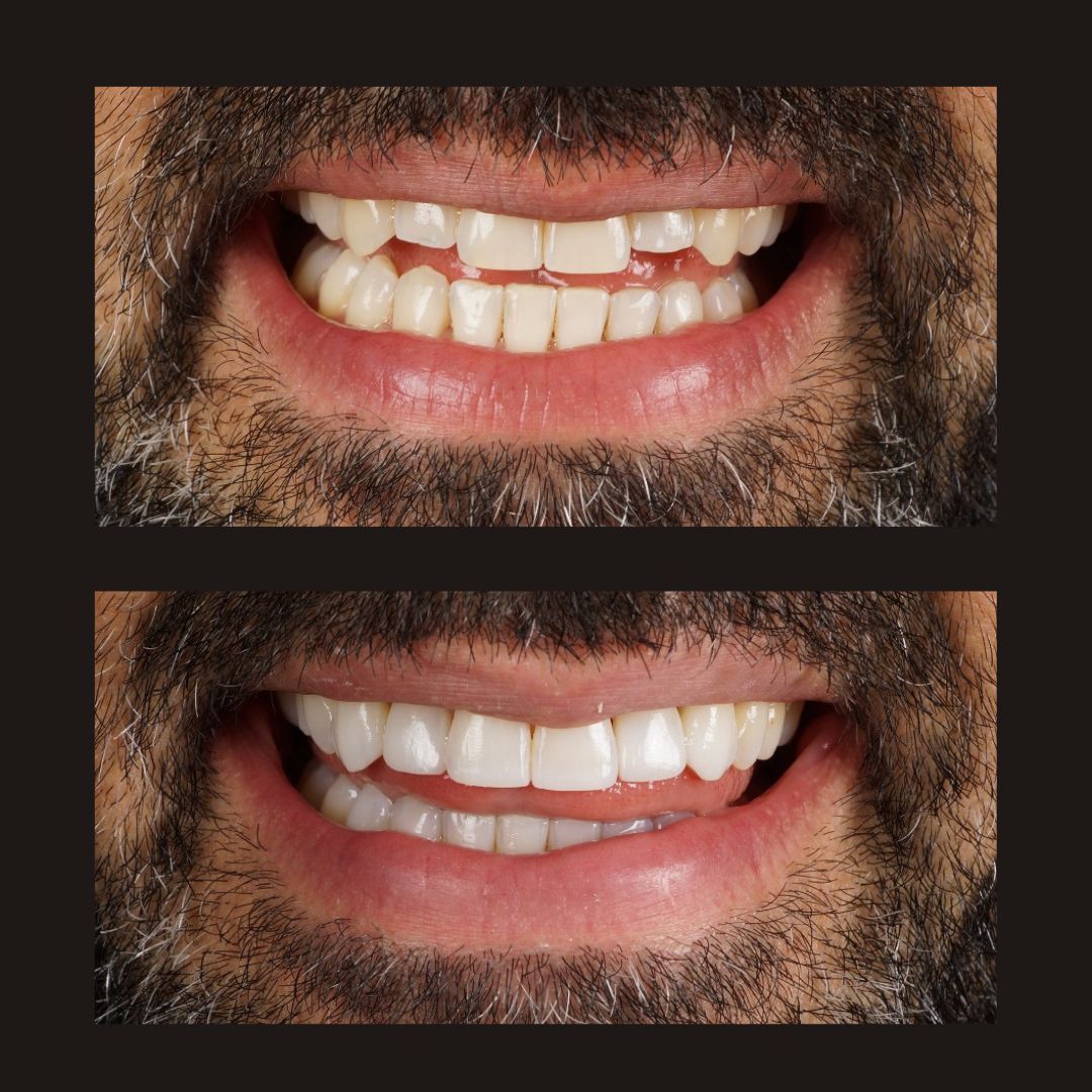 Raimonda Bogdanoviciute-19