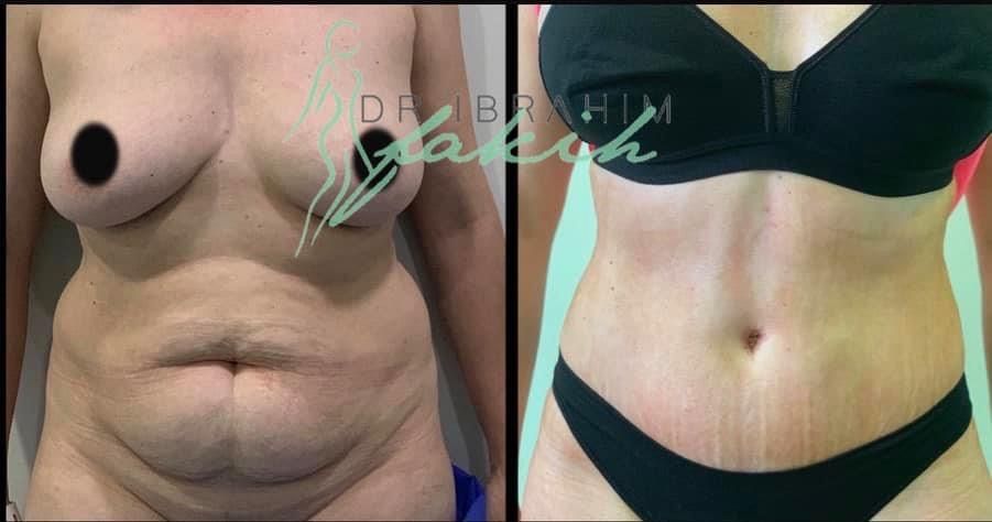 Ibrahim Fakih Gómez-8