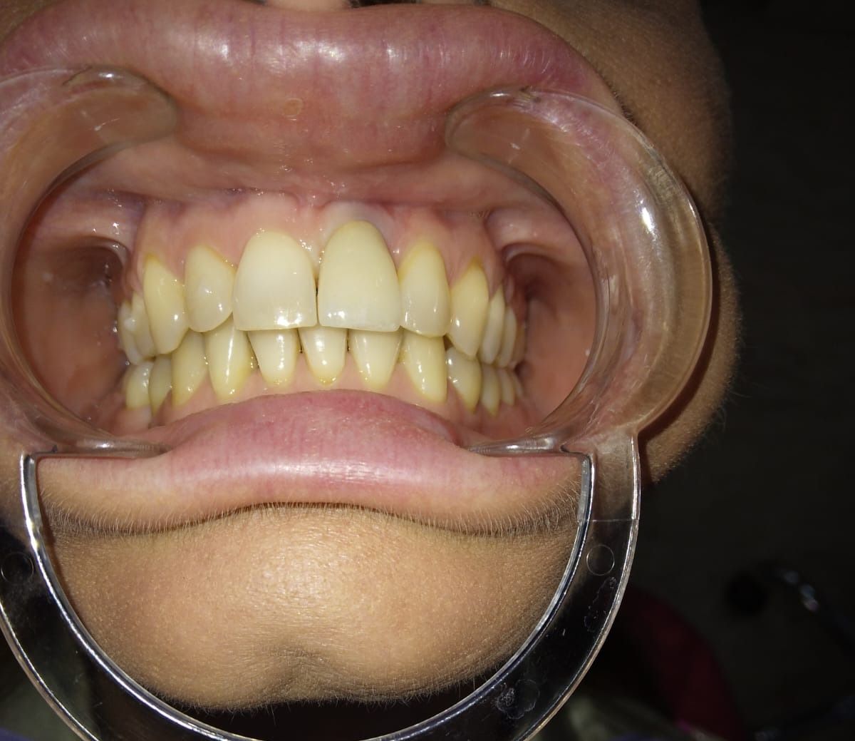 Luigi Aiardo Esposito-18