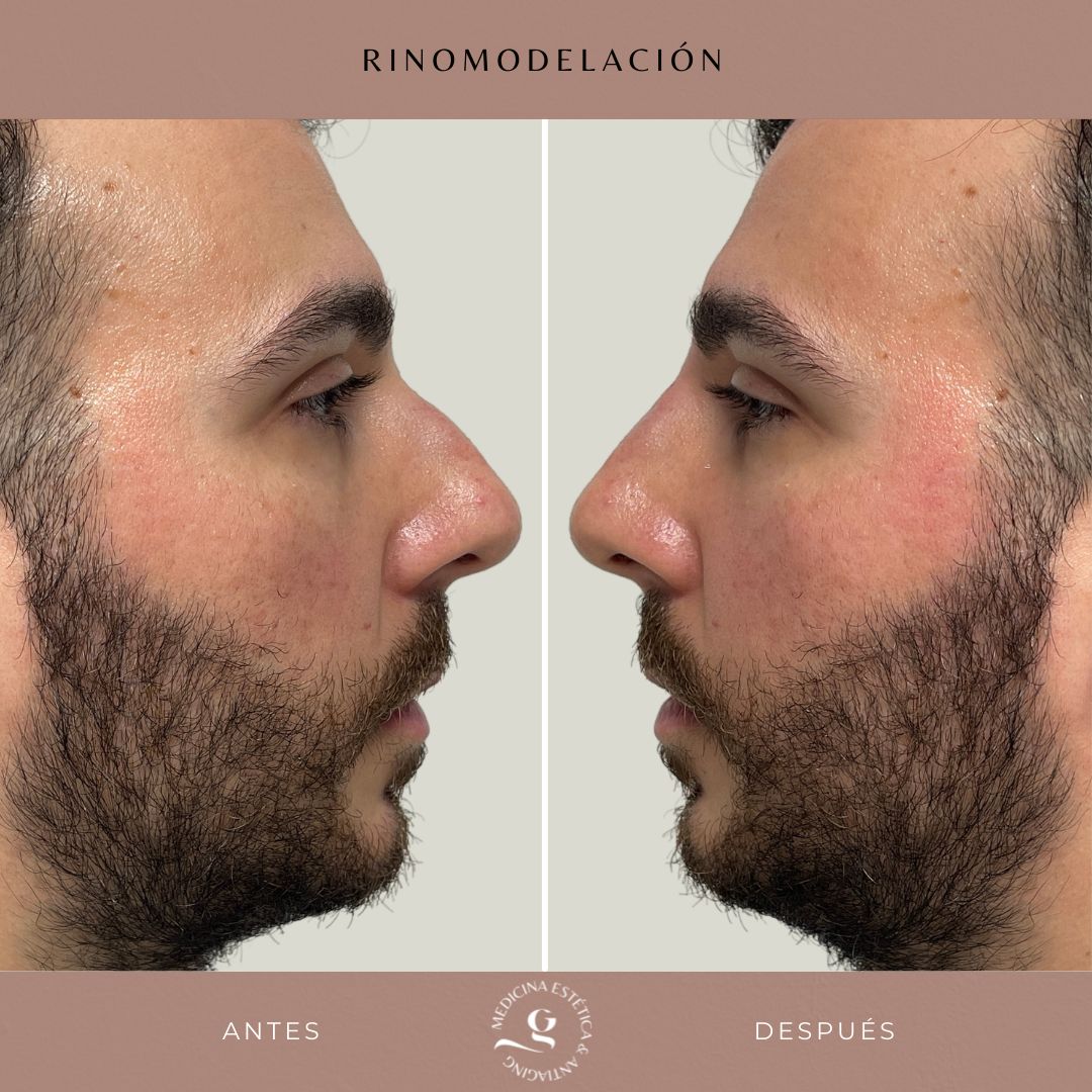 ​Giovanni Giorgianni-38