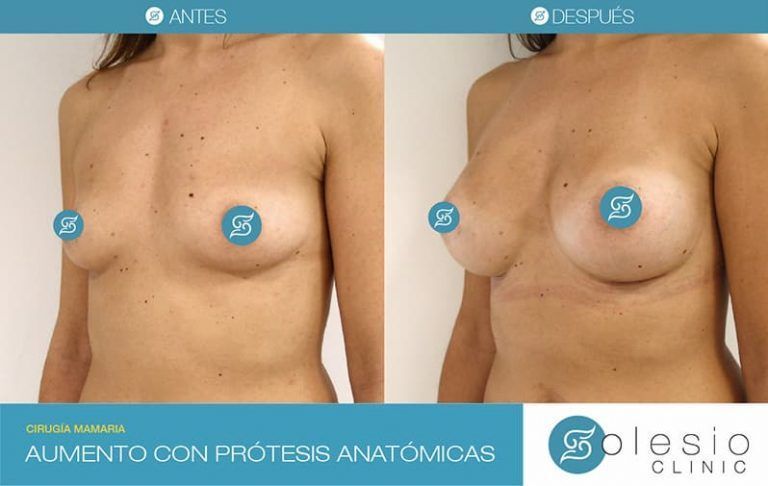 Francisco Solesio Pilarte-4