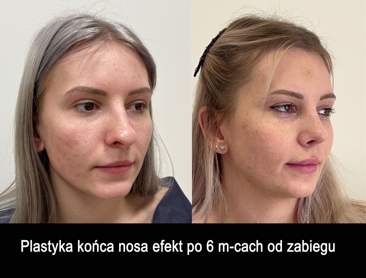 Mariusz Zagajewski-37