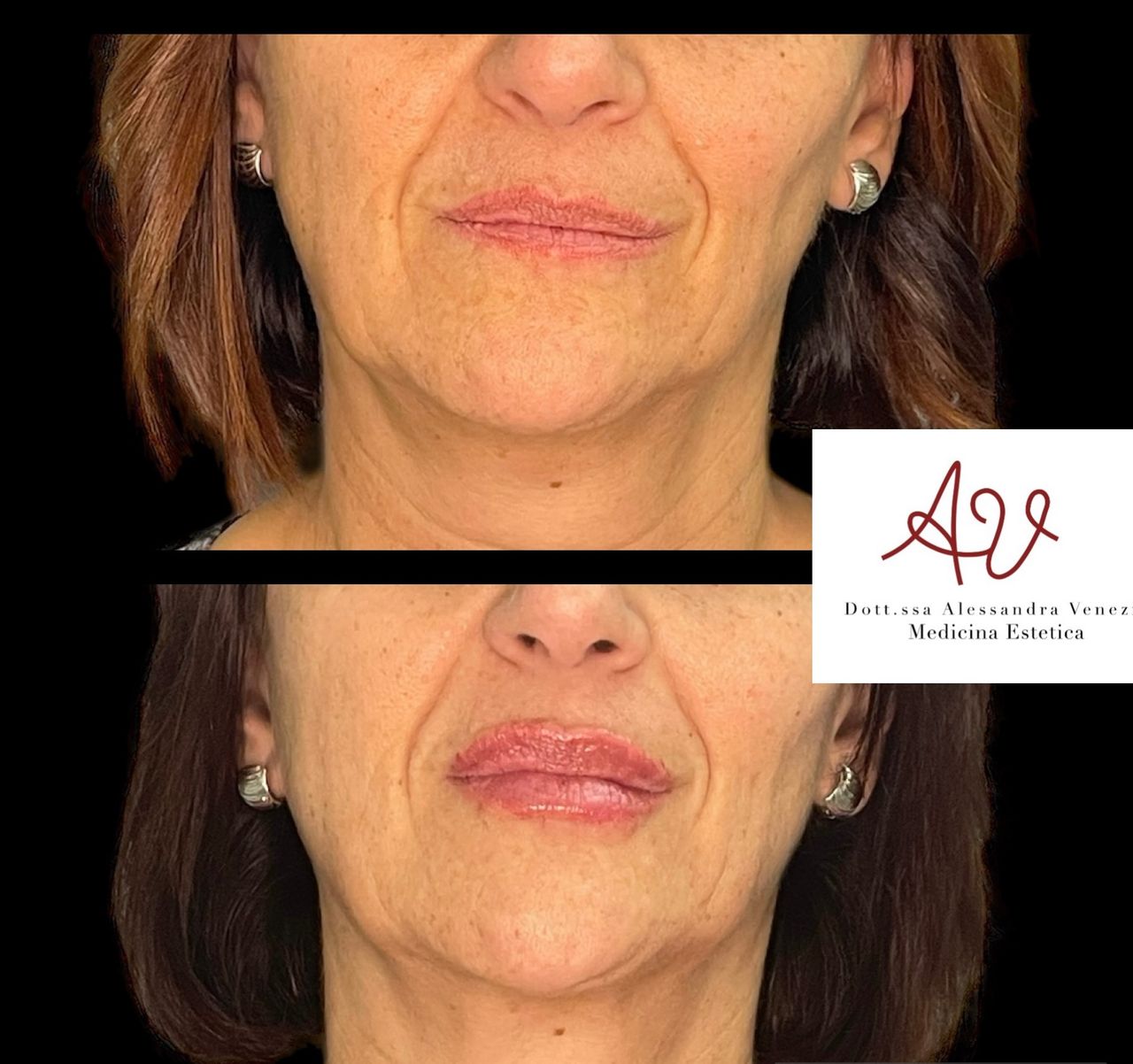 Alessandra Venezia-22