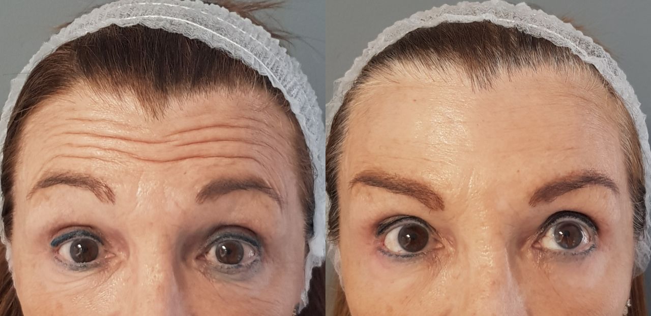 Rosalba Herrero Zerpa-495