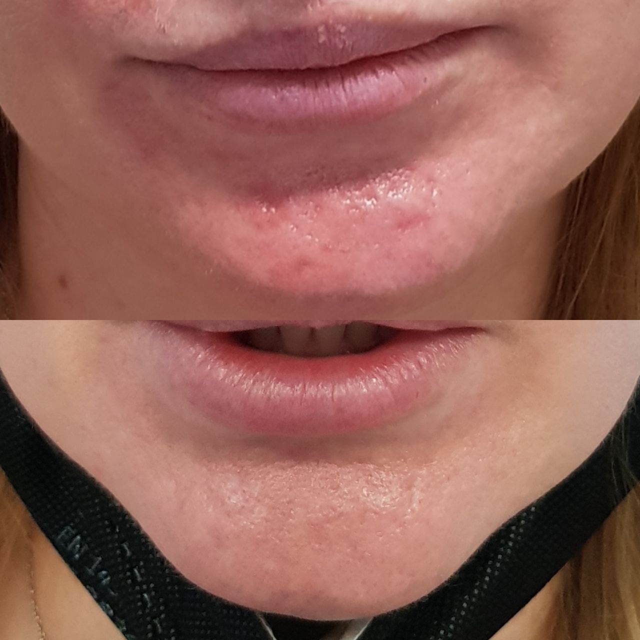 Rosalba Herrero Zerpa-247