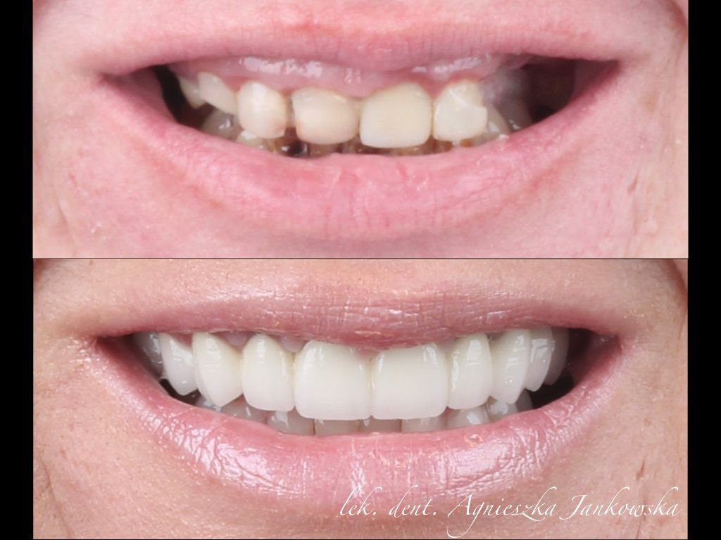 Agnieszka Jankowska-Smolińska-3