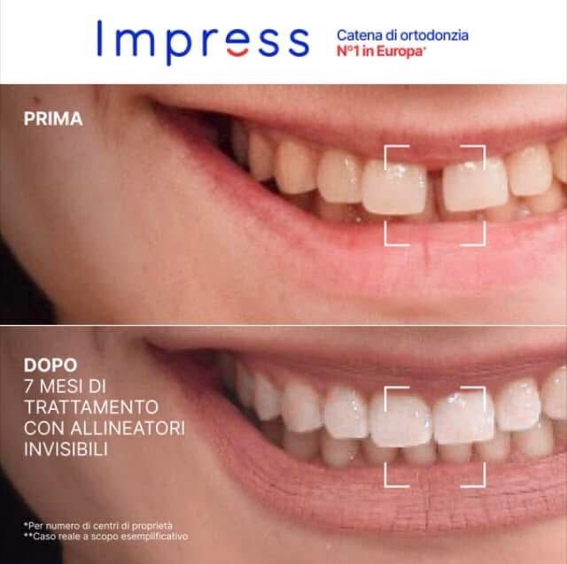 Riunito Dentista Dentalpar-7