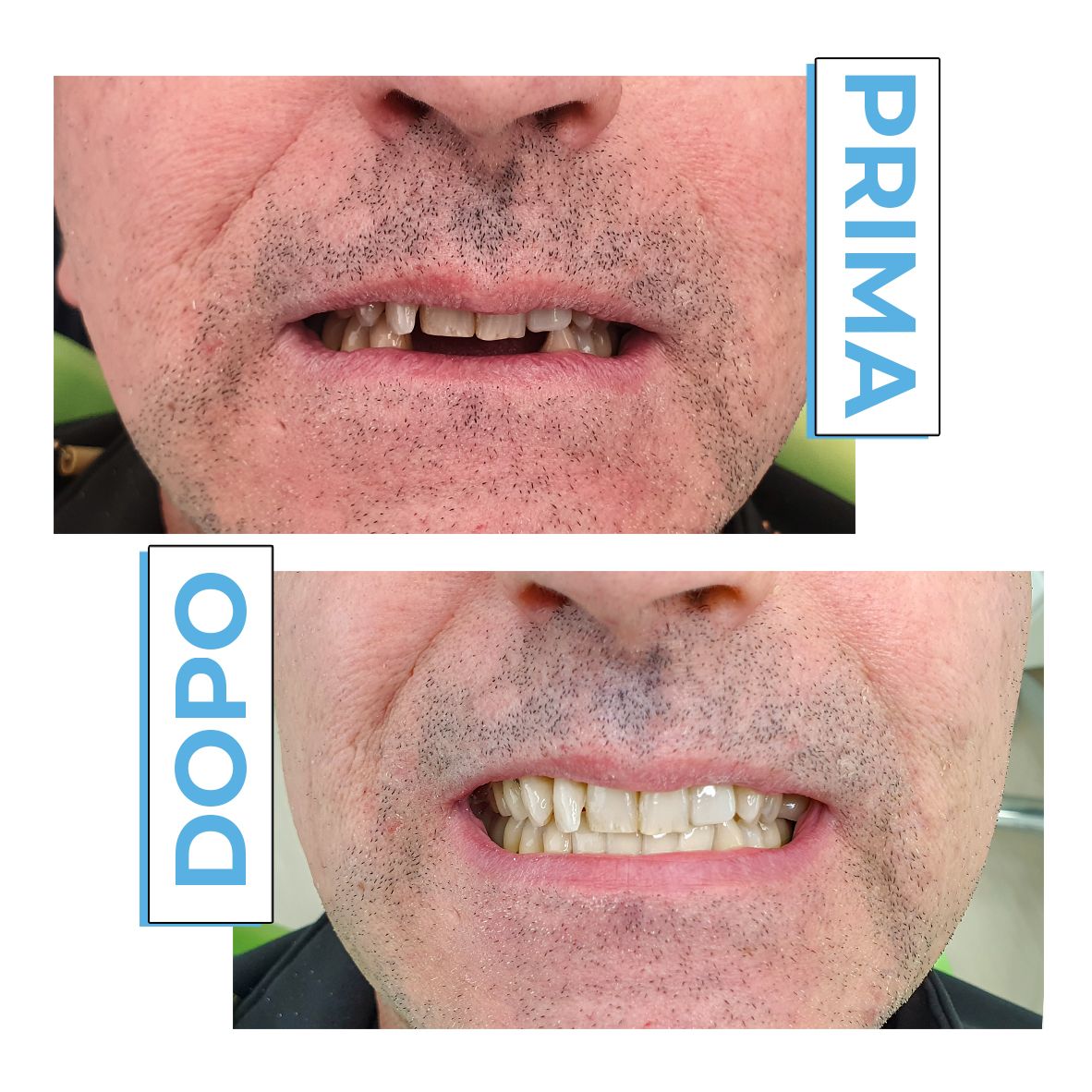 Francesco Anaclerico-20