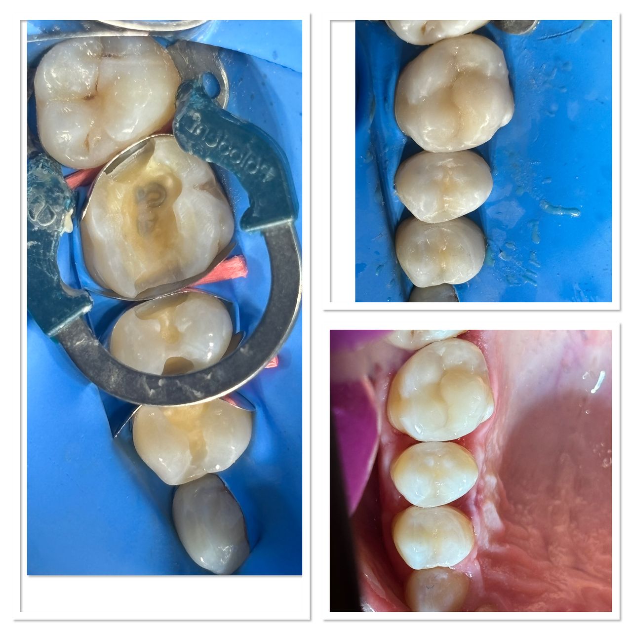 Anna Chmielecka-Borusewicz-11