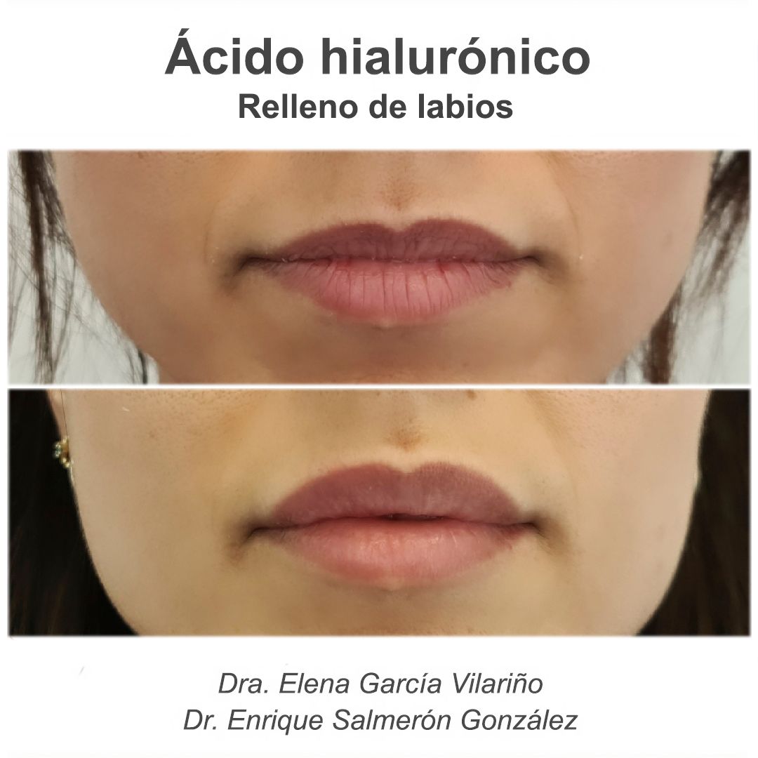 Enrique Salmerón González-80