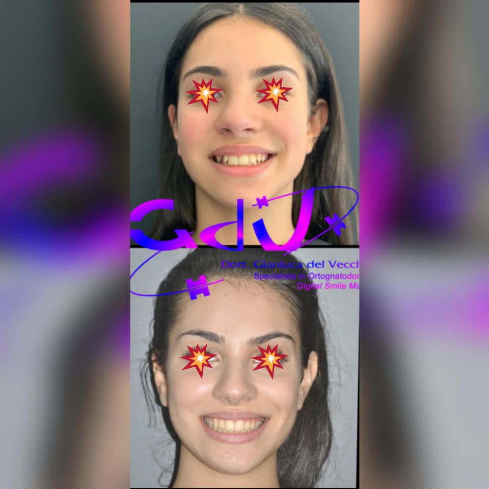 Gianluca Del Vecchio-143