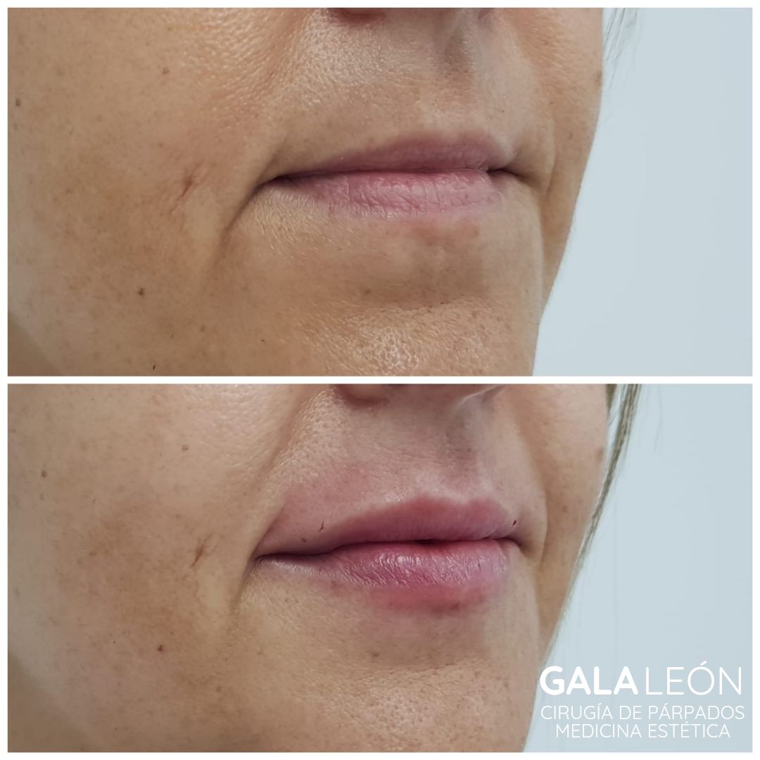 Gala P. Leon Salvatierra-28