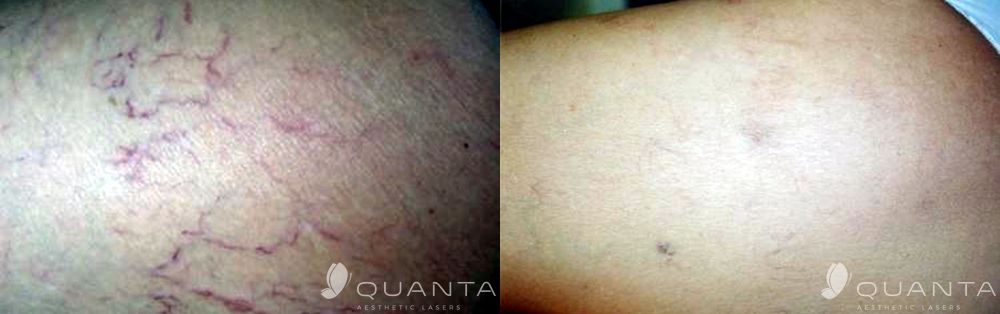 Enzo Angelo Giudice-17