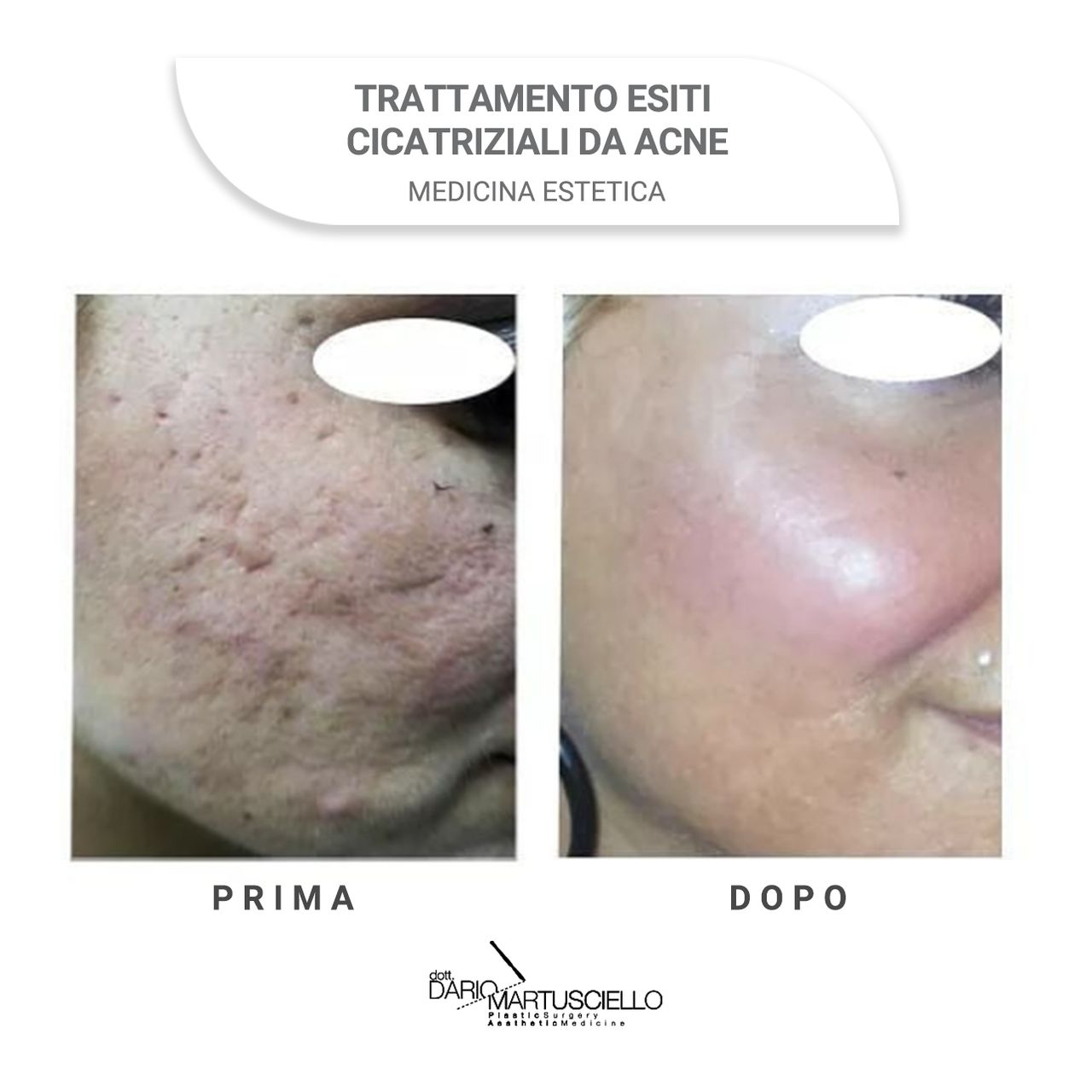 Dario Martusciello-11