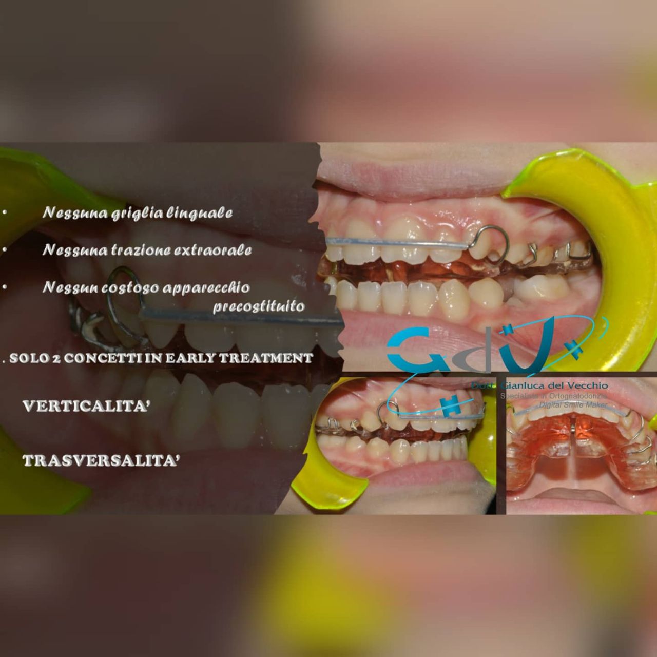 Gianluca Del Vecchio-156